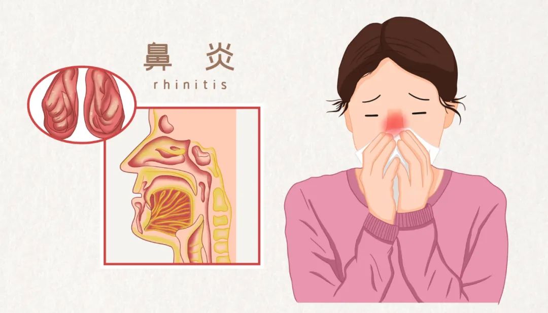 秋冬想要少生病，一定要拍打此处，大病小病它都管！(图10)