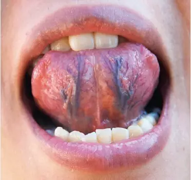 从舌头看健康：你是这七种体质中的哪一种？(图8)
